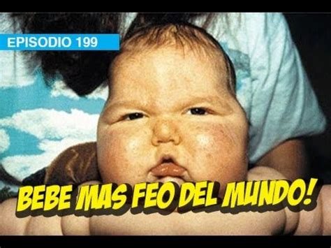 Fotos Del Beb Mas Feo Del Mundo Imagui