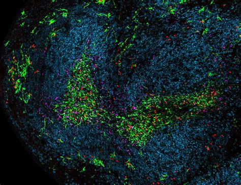 Why Sentinel Cells are so Important | Mirage News