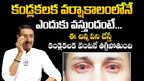 కడల కలక వసత ఇలట జగరతతల తసకడ Conjunctivitis Symptoms