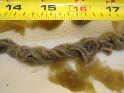 What Does the Rope Worm Look Like – Rope Worms – What are They?