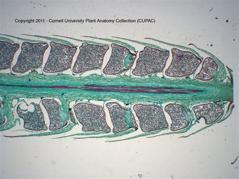 CUPAC ANATOMY SLIDE IMAGES