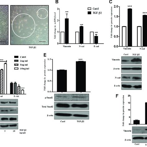 Tgf Induces Emt Through Smad Signaling In Huh Cells A