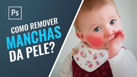 Como Remover Manchas Na Pele No Photoshop Youtube