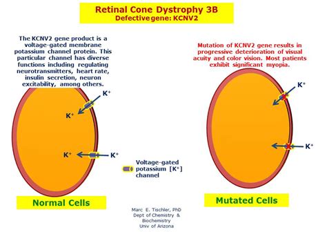 Retinal Cone Dystrophy 3B | Hereditary Ocular Diseases