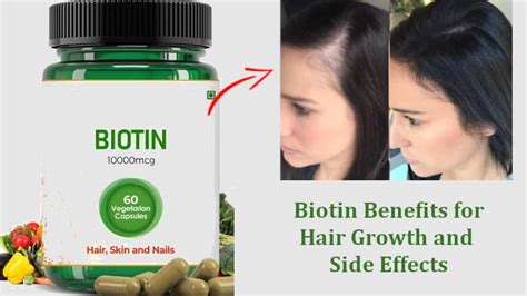 Biotin Benefits For Hair Growth And Side Effects