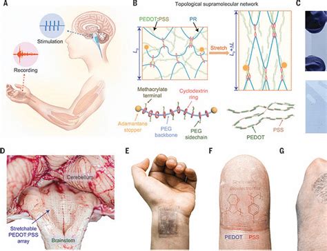 Topological Supramolecular Network Enabled High Conductivity