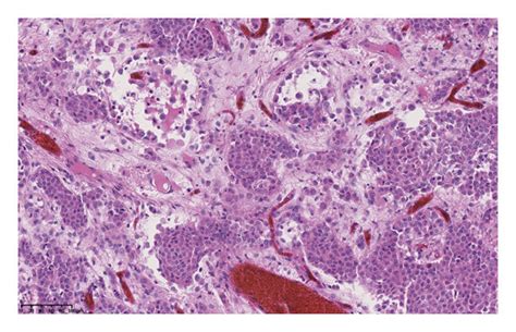 Characterization Of The Lesions On Mri Macroscopic Microscopic And