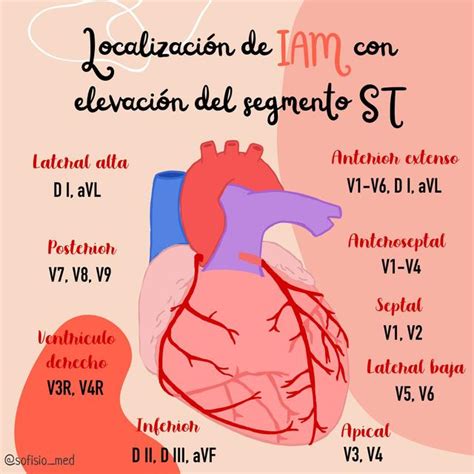 Localizaci N Del Iamcest Con Las Derivaciones Del Ekg Udocz