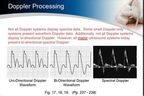 Doppler Instrumentation Flashcards Quizlet