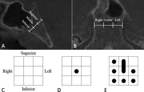 A B The Spheno Occipital Synchondrosis Was Divided Into Three Parts Download Scientific