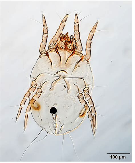 Dermatophagoides farinae (female). | Download Scientific Diagram