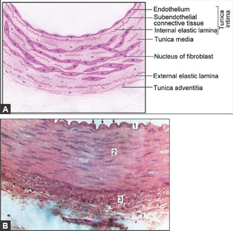 Muscular Artery Vs Elastic Artery Histology