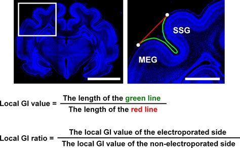 Figures And Data In Gyrification Of The Cerebral Cortex Requires Fgf