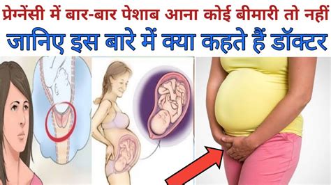 Pregnancy Mein Bar Bar Peshab Kyon Aati Haihow To Control Frequent