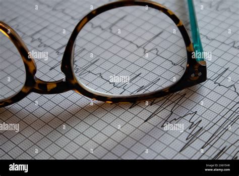 Doctor Reading Ecg Hi Res Stock Photography And Images Alamy