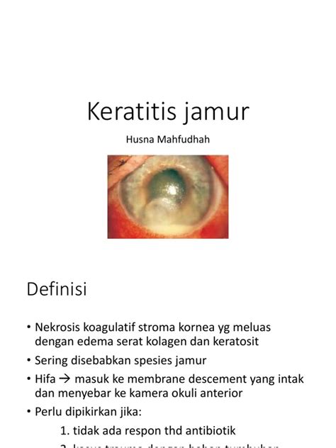 Keratitis Jamur Pdf