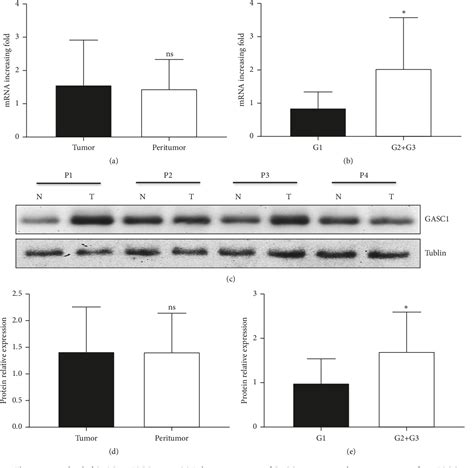 Figure 2 From Gasc1 Promotes Stemness Of Esophageal Squamous Cell