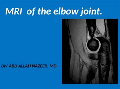 (PPTX) Presentation1.pptx mri of elbow joint - DOKUMEN.TIPS