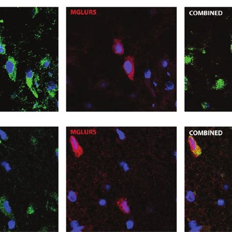 Expression of components of the FMR1 protein/mammalian target of ...