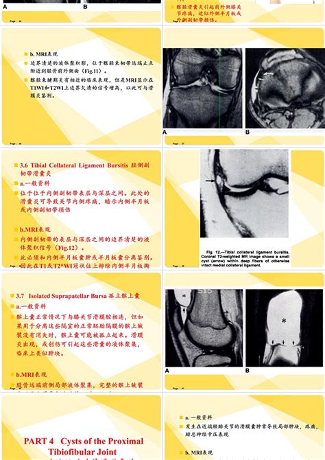 Cxj Mri Ppt