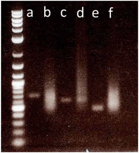 Probe Quantity Determination An Agarose Gel Image Showing The Quantity