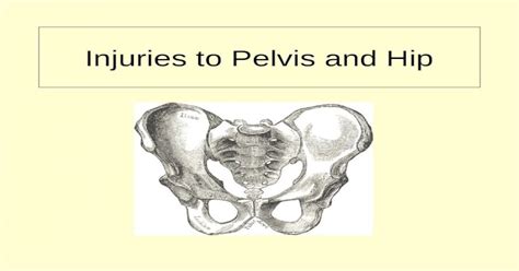 Ppt Injuries To Pelvis And Hip Anatomy Of Pelvis Bones Of Pelvic Girdle 1 Ilium 2 Ischium 3