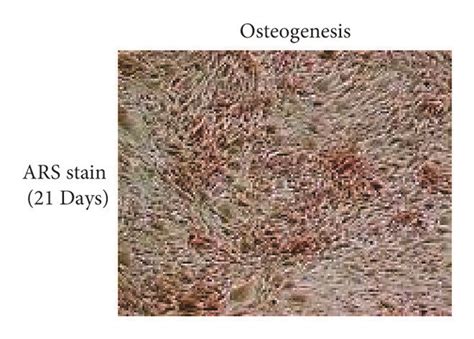 Bone Marrow Derived MSCs Differentiate Into Mature Osteoblasts The