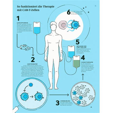 LMU Klinikum Erste Ambulante CAR T Zell Therapie