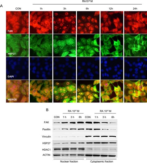 RA Induces A FAK Paxillin And HSP27 Nuclear Localization A T 47D