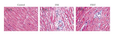 Fxst Alleviated Stz Induced Cardiac Fibrosis In Dm Rats A