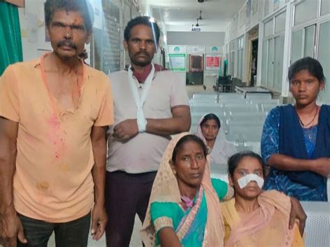 Miscreants Cut Off The Nose Of The Daughter Who Came To Rescue Her Father बदमाशों ने पिता को