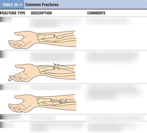 Peds Exam 3 Common Fractures Diagram Quizlet