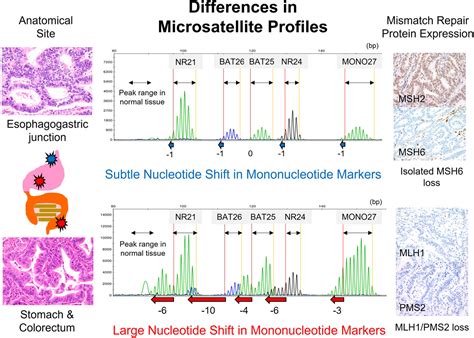 Microsatellite Instability Profiles Of Gastrointestinal Cancers