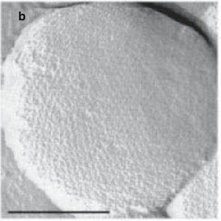 Electron micrographs of cells of "Nanoarchaeum equitans" attached to... | Download Scientific ...