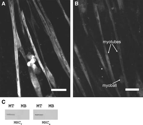 Fast And Slow Myosin Heavy Chain MHC Isoform Expression In