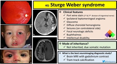 Sturge Weber Mri