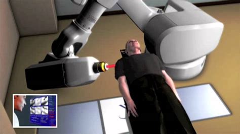 Cyberknife Treatment Option Youtube