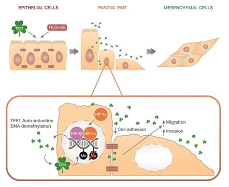 Ijms Special Issue Epithelial Mesenchymal Transition Emt