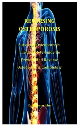 Reversing Osteoporosis Surviving Osteoporosis The Complete Guide To