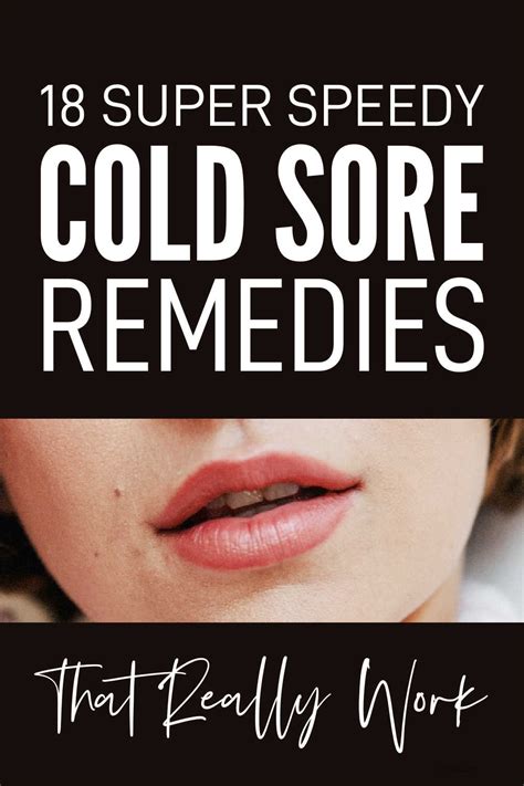 Natural Remedies For Cold Sores