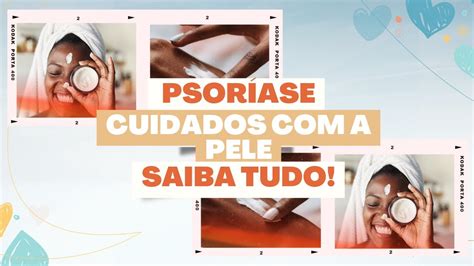 Psoríase Cuidados a pele Saiba tudo YouTube