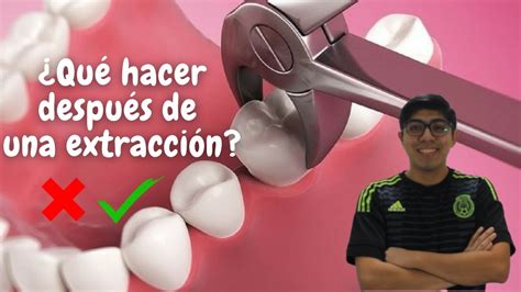 Tips Después De Una Extracción Dental Youtube