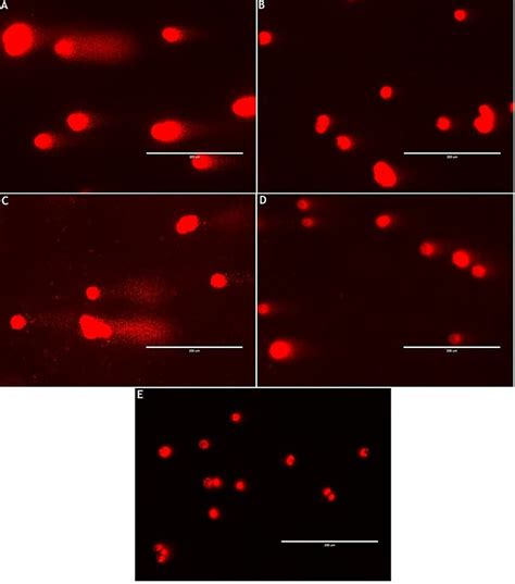 Representative Photomicrography Images Of Comet Assays Performed To