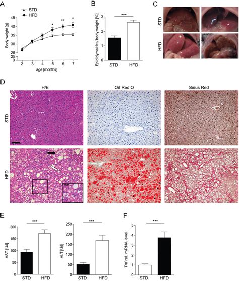 Increased Body Weight And Liver Inflammation In Mice Upon 20 Week