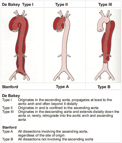 Aortic Dissection New Frontiers In Diagnosis And Management Circulation