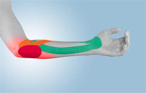 Fisioterapia Para El Dolor Los Dolores Y La Tensión Del Codo Imagen de