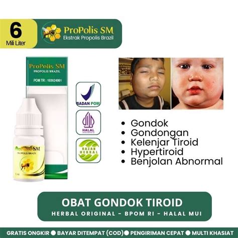 Jual Propolis Sm Obat Pengempis Gondok Kelenjar Getah Bening Tiroid