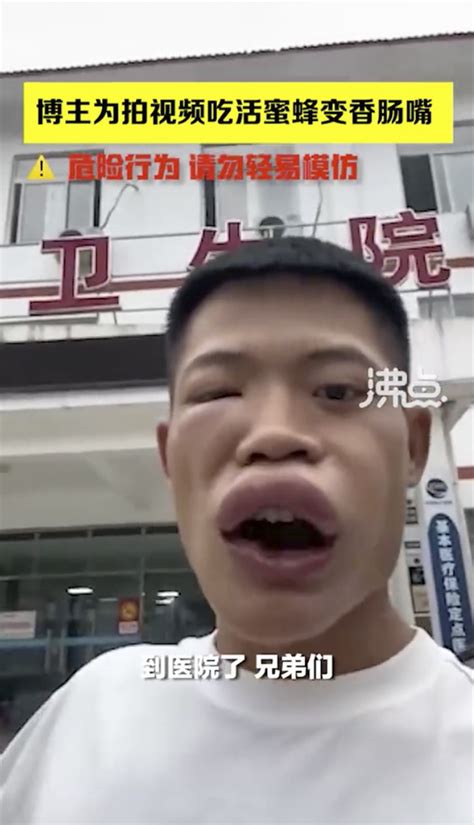 ‘Sausage lips’: Chinese influencer cancelled after wasp-eating video