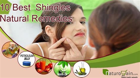 Natural remedies for shingles