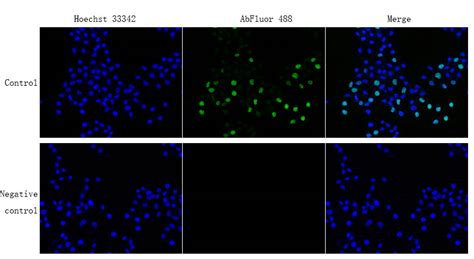 Edu Cell Proliferation Image Kit Green Fluorescence Abbkine